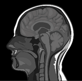 A close-up of a brain

Description automatically generated with medium confidence